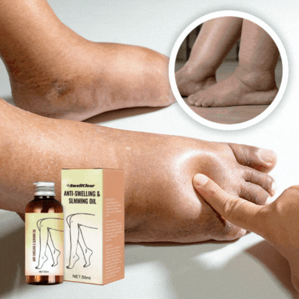 SwiftEU™ | Riduce il gonfiore delle gambe del 90% in soli 7 giorni
