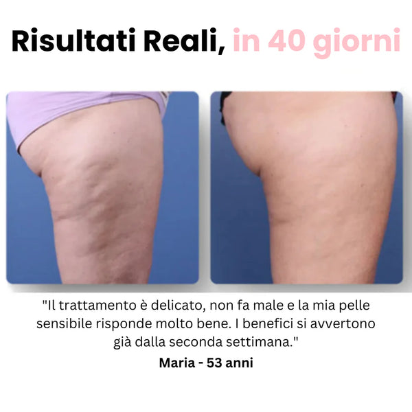 Cellufree™ Cellulite Relief Kit