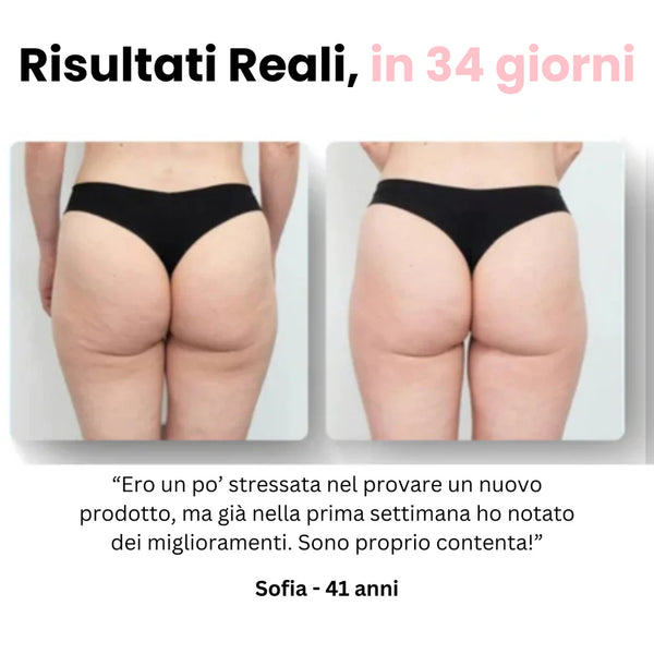 Cellufree™ Cellulite Relief Kit